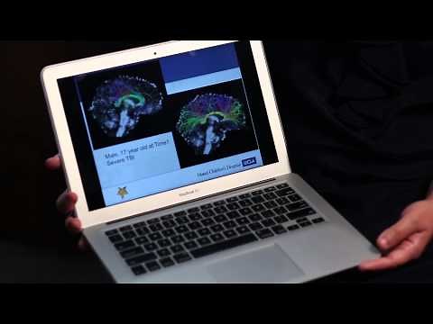 Career Profile - Neuropsychology