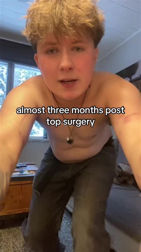 Post-Top Surgery Reflections: My Proportions