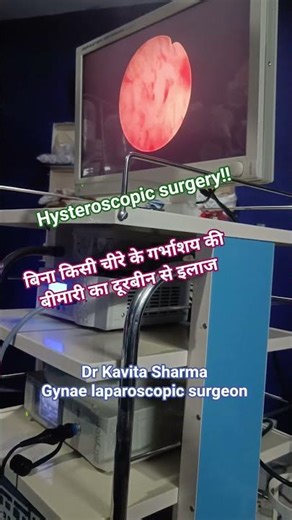 Hysteroscopic polypectomy!! Surgery for uterine disease through telescope Dr. Kavita Sharma