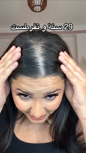 شعرك يطيح و لا لالا ؟ @ivy_laboratory #🇩🇿 #chutedecheveux #تساقط_شعر #shampoing #masque | Fella Khe