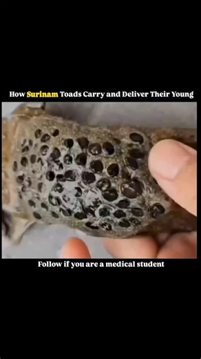 @medicalstudent.io | The Surinam toad carries motherhood to an extraordinary extreme as the female embeds her fertilized eggs directly into the skin of her own... | Instagram