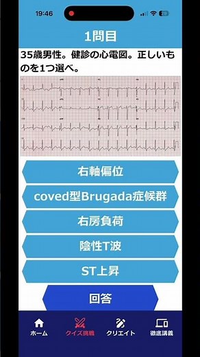 心電図検定1級問題