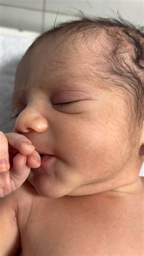 Cute Preterm Baby in NICU Sleeping Peacefully After Feeding 😴👶❤️ #PretermBaby #NICUBaby🤲🙏❤️