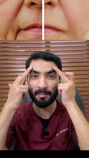 119K views · 4.5K reactions | A lifted, fresher look in just 15 minutes. Face thread lift with natural, confident results. #dradnanorakzai #plasticsurgery #AestheticClinic #facelift #islamabad #Peshawar | Dr Adnan Orakzai | Facebook