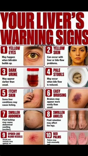 10 Warning Signs Your Liver Is Crying for Help! ⚠️ Don't Ignore These Symptoms