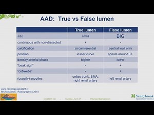 True vs. False Lumen in Acute Aortic Dissection