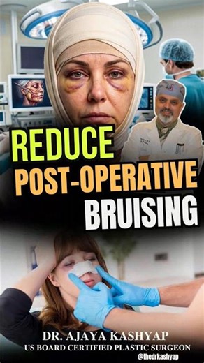 Reduce Post-Operative Bruising | Dr. Ajaya Kashyap