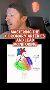 Why it’s important to know what EKG leads are associated with which coronary arteries! . Check out the Nurse Dose Cheat Sheets and Resources in the bio! . Follow for more ICU nursing education! 🎓 . #cvicu #cardiacnurse #criticalcare #nursingschool #icunurse #newgradnurse #newgradrn #nursesofinstagram #icunurselife #flightnurse #criticalcarenurse #emergencydepartment #nurselife #paramedic #ernurses | Nurse Dose Podcast