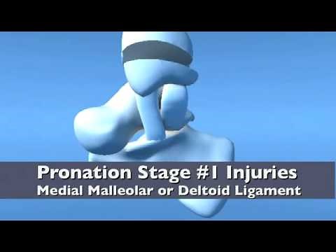 Introduction to Lauge Hansen & Danis Weber Classifications Ankle Fracture