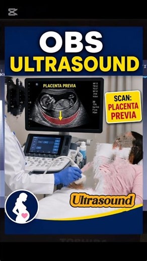 Placenta Previa Ultrasound | Placenta Covering internal os | Placenta Previa types and Grading