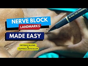 The #1 Nerve Block Technique You Need to Know About NOW