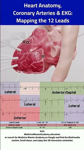 Heart Anatomy, Coronary Arteries and EKG: Mapping the 12 Leads. #heart #cardiology #ecg #ekg