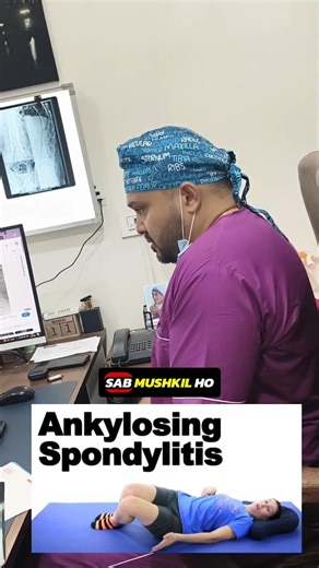 Ankylosing Spondylitis- turn spine into Bamboo