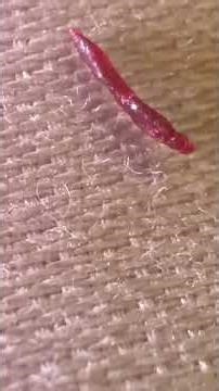 Cocoons under the skin long red thing is this alien particle not sure what it is