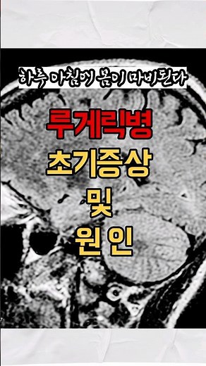 루게릭병 초기증상 및 원인. 해당된다면 바로 병원가세요!