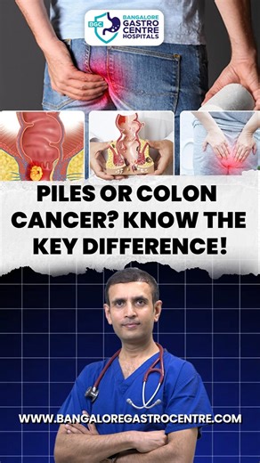 Blood in Stool? Don’t Ignore It | Piles or Colon Cancer Explained | Bangalore Gastro Centre Hospital
