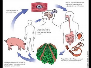 Cysticercoid and Cysticercosis ; Definition, Causes, Symptoms, Diagnosis, Treatment
