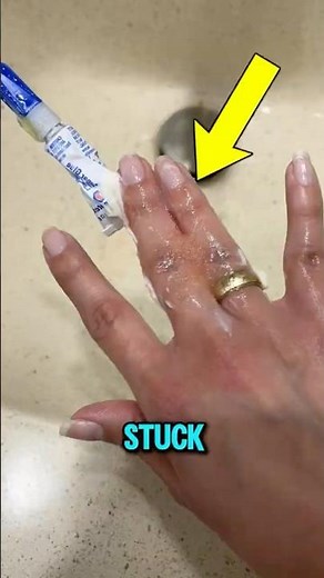How to Safely Remove Super Glue From Your Fingers 😱