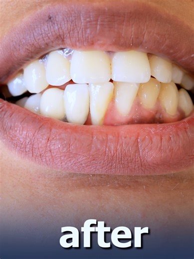 #geez ##Multispecialty #dentalcenter #implant #dentalclinicinmekelle