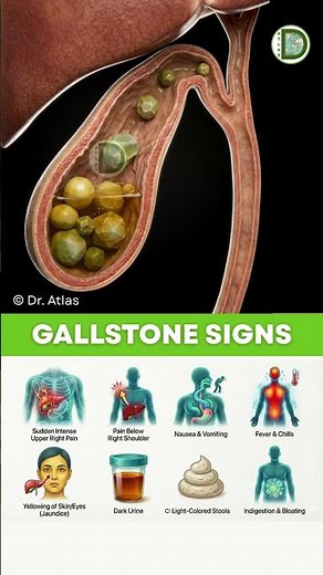 8 Gallstone Warning Signs Most People Ignore - Check Yours Today