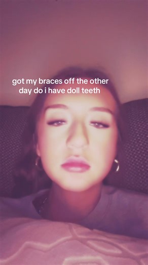 Braces Off: The Transformation to Doll-Like Teeth