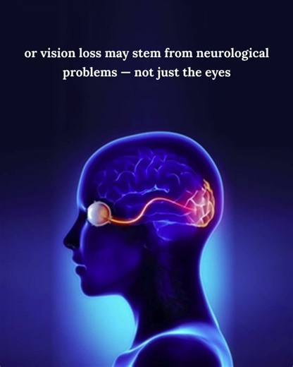👁️🧠 When vision problems start in the brain, not the eyes…\nNeuro-ophthalmology bridges the gap bet