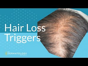 Common Hair Loss Triggers