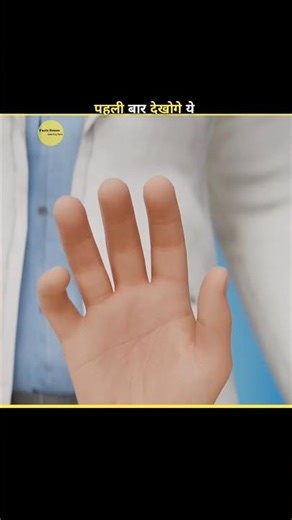 Doctors Attached his hand to his Leg😨 #facts