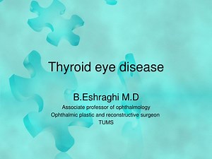 Thyroid eye disease - SlideServe