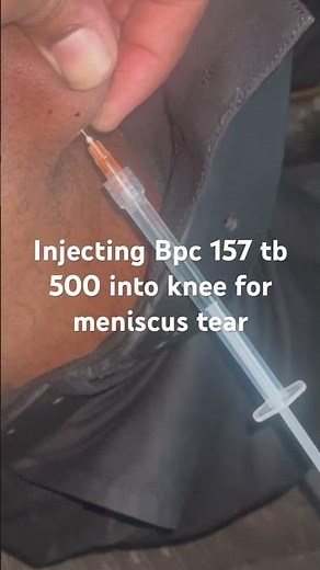 Injecting Bpc 157 tb 500 into knee for meniscus tear #bpc157 #meniscus tear cus