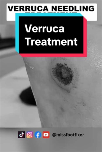 MissFootFixer | Marion Yau on TikTok