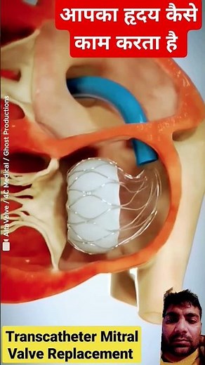 #anatomy #medicalanimation #physiotherapy #chiropractic #medicalstudent #medical #animation