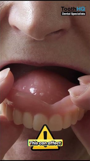What happens if I don’t get a denture after tooth removal?