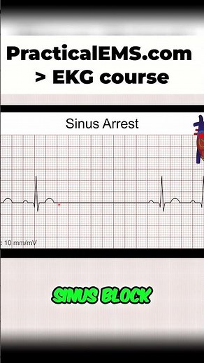 Sinus Pause, Block, Arrest: ECG Interpretation Explained Simply