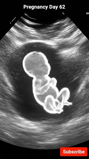 62 days Baby Ultrasound (Week 9) | Ultrasound View 👶 #ultrasound #viralvideo