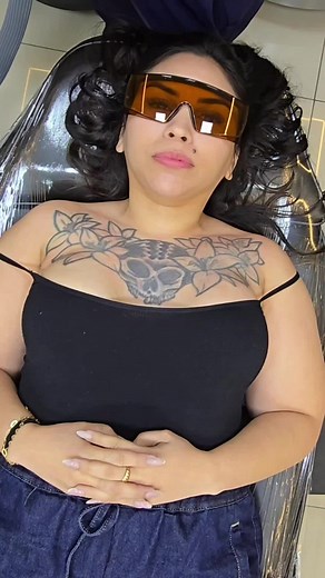 Remoção de Tatuagem com Lasers de Alta Tecnologia