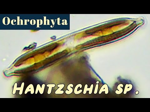 Hantzschia (Bacillariophyceae or Diatoms)
