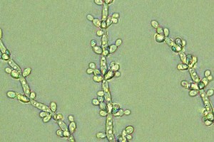 Candida tropicalis - Alchetron, The Free Social Encyclopedia