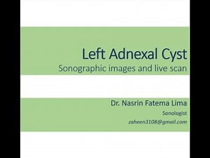 Sonographic view of Adnexal Cyst II Images & live scan II Dr. Nasrin Fatema