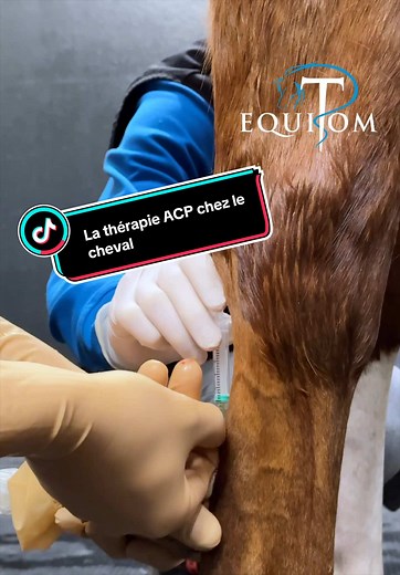 La thérapie ACP chez le cheval La médecine régénérative joue un rôle de plus en plus important dans la médecine sportive équine moderne et la rééducation. L’un des traitements les plus utilisés aujourd’hui est la thérapie ACP : un traitement biologique basé sur le propre sang du cheval. L’ACP (Autologous Conditioned Plasma) est un produit sanguin concentré riche en plaquettes et en facteurs de croissance. Ces facteurs de croissance jouent un rôle important dans la réparation des tissus, la cicat
