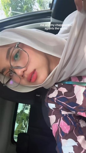 Battling Chapped Lips: My Personal Experience