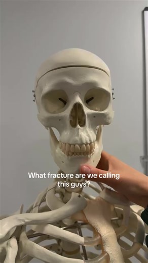 Identifying Fractures in Paramedic Training