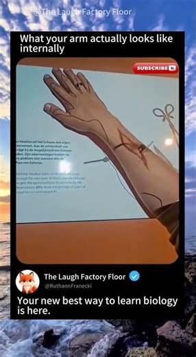 🔍 This is what your Arm 💪🏻 looks like Inside 🔬 | MDCT