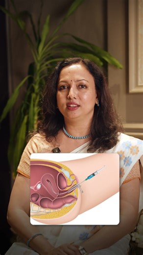 Common Doubts about IUI l IUI Procedure l Do's and Don'ts of IUI l Precautions to take