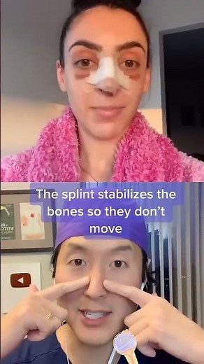 Amazing Nose Job Transformation! #shorts