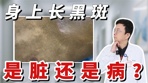 身上黢黑，是脏还是病？