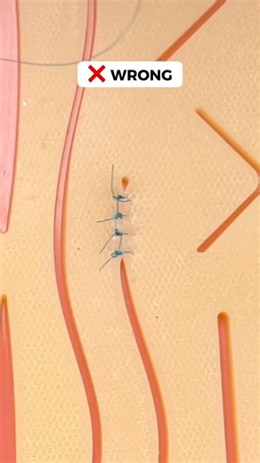 Sutures Too Close to the Edge? 🤔 #medicaleducation #clinicalskills #suturing