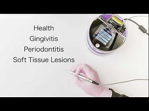 What The Dental Hygiene Laser Does with Biolase Epic Hygiene