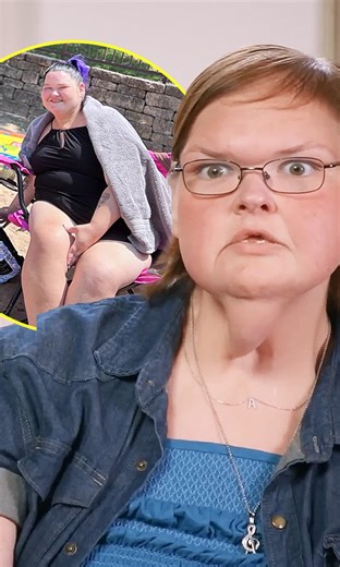 Slaton sisters post skin surgery results