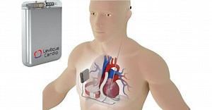 Implantable battery milestone toward Leviticus Cardio U.S. LVAD Trial